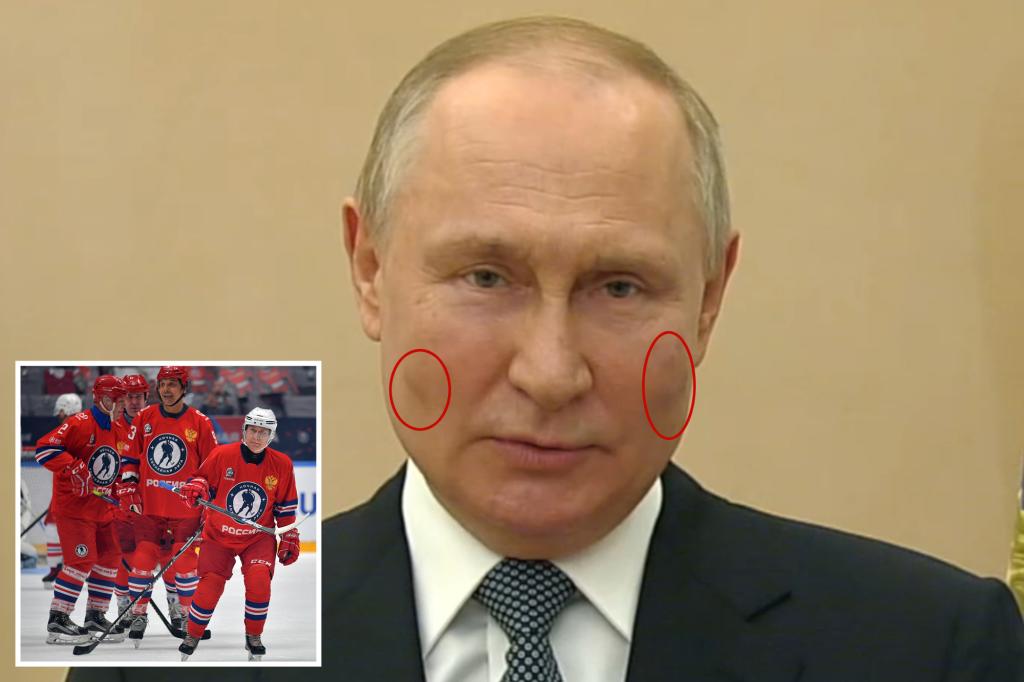 Putin foi flagrado com manchas nas bochechas depois de pular um jogo de hóquei