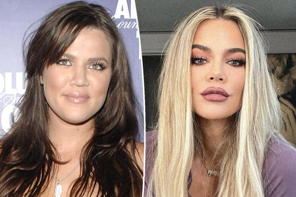 Khloé Kardashian fala sobre rumores de transplante de rosto