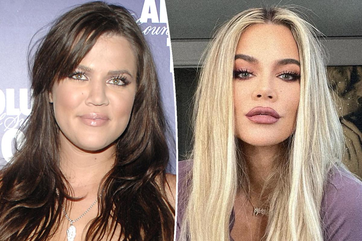 Khloé Kardashian fala sobre rumores de transplante de rosto

